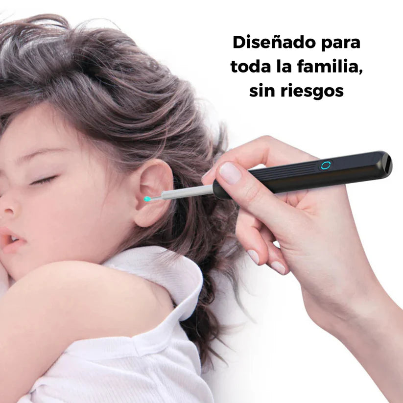 OtoCam™ – Limpieza Segura de Oídos con Cámara HD