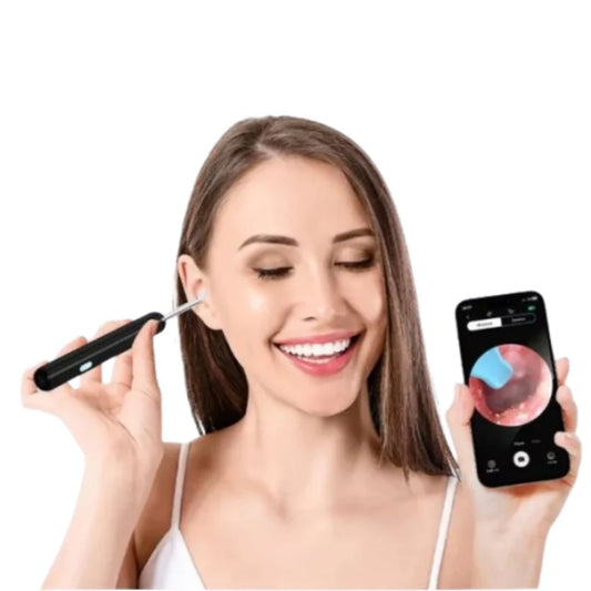 OtoCam™ – Limpieza Segura de Oídos con Cámara HD