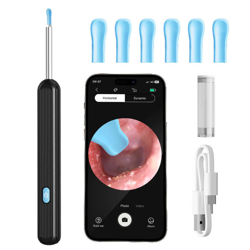 OtoCam™ – Limpieza Segura de Oídos con Cámara HD