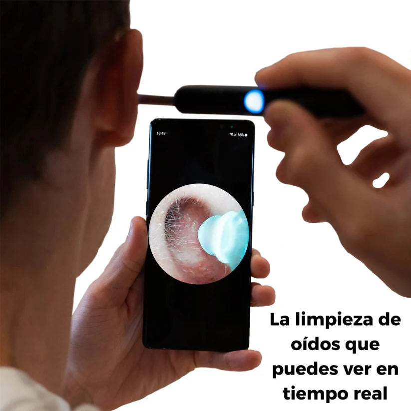 OtoCam™ – Limpieza Segura de Oídos con Cámara HD
